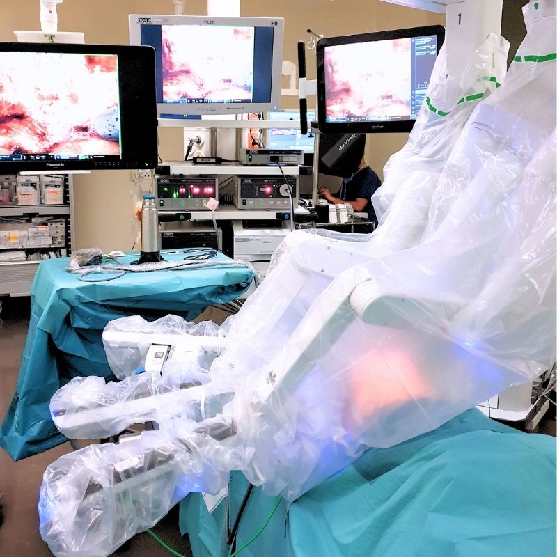 Robotic surgical system prepared for abdominal wall surgery with operative monitors visible in the operating room.