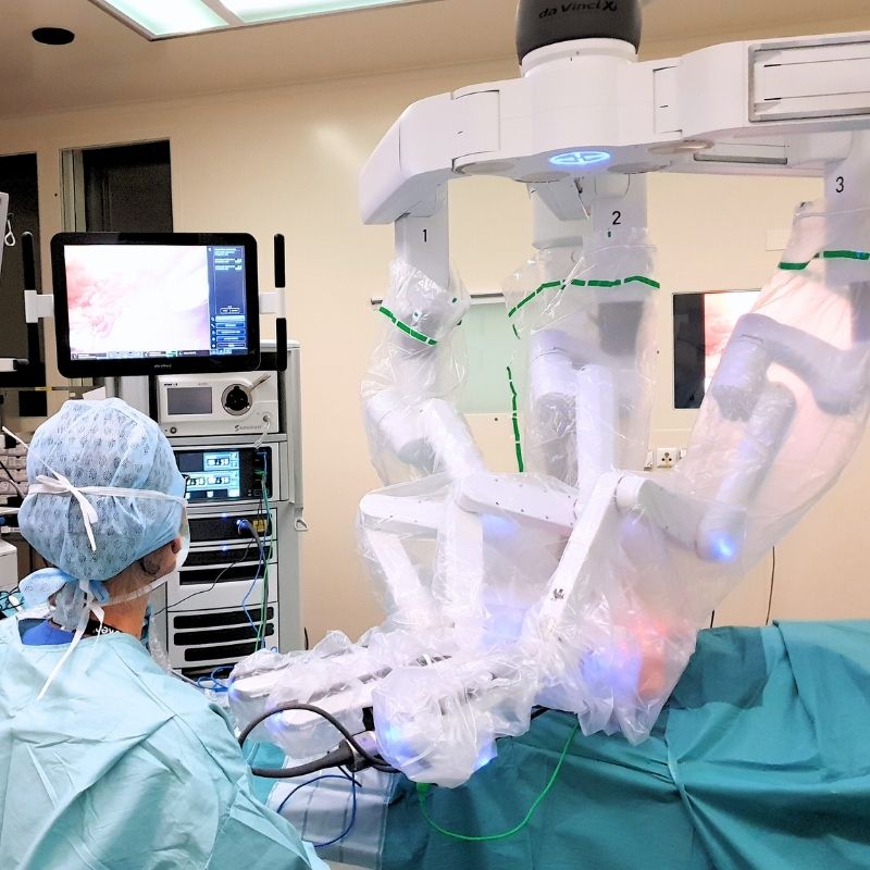 Robotic surgical system and operative monitors in the operating room during minimally invasive ventral hernia repair, supporting precise dissection and controlled reconstruction.