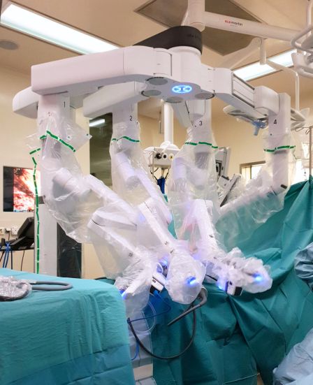 Robotic surgical system prepared in the operating room for abdominal wall reconstruction, supporting precise dissection and controlled anatomical repair.