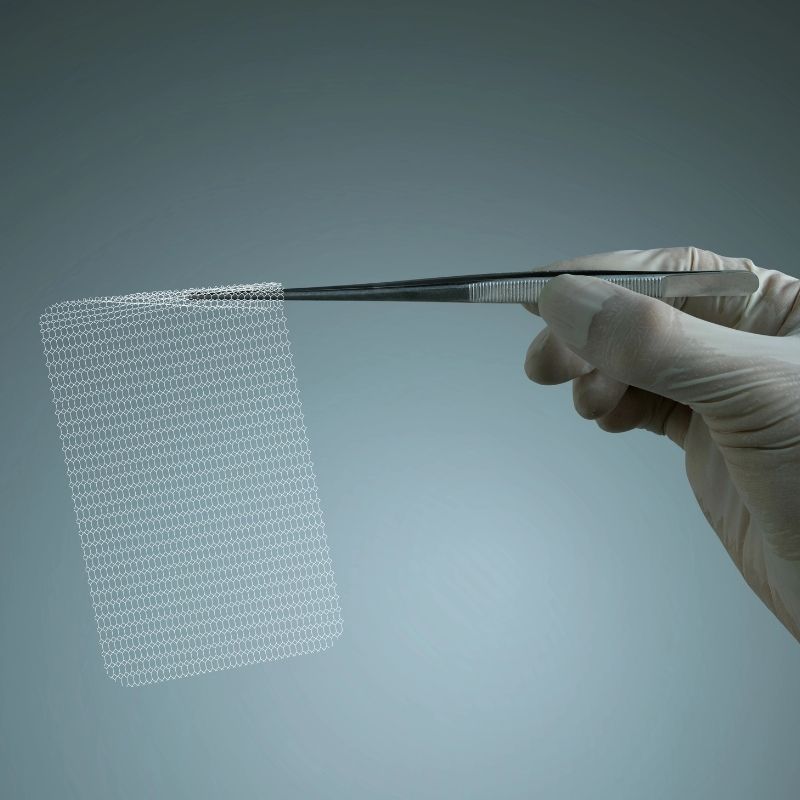 Surgeons use surgical mesh to treat hernias.