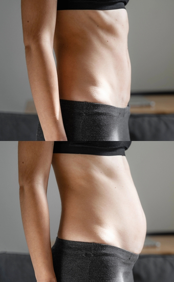 Before and after young woman side view of body. swollen belly. pregnancy. diastasis recti after child birth. fitness exercises and diet for weight loss.